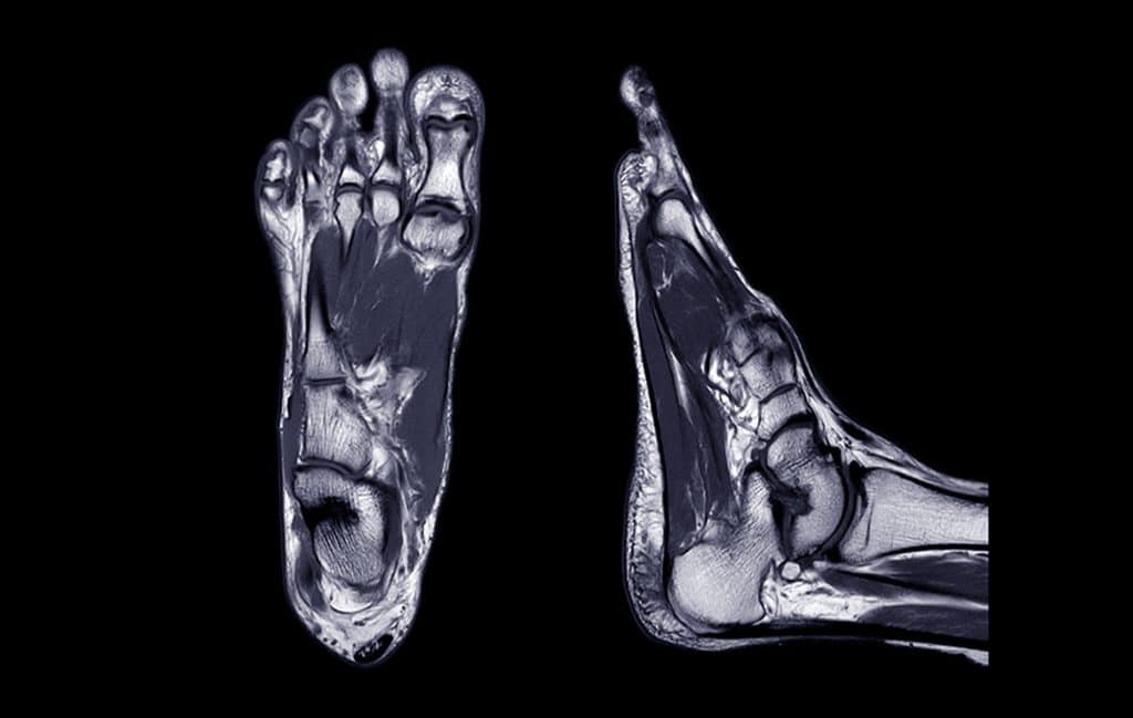 „MRT Bild eines Fußes zur Diagnose von Sehnenschmerzen und Sehenverletzungen